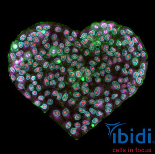 Technology Seminar: ibidi&ndash;Cells in Focus